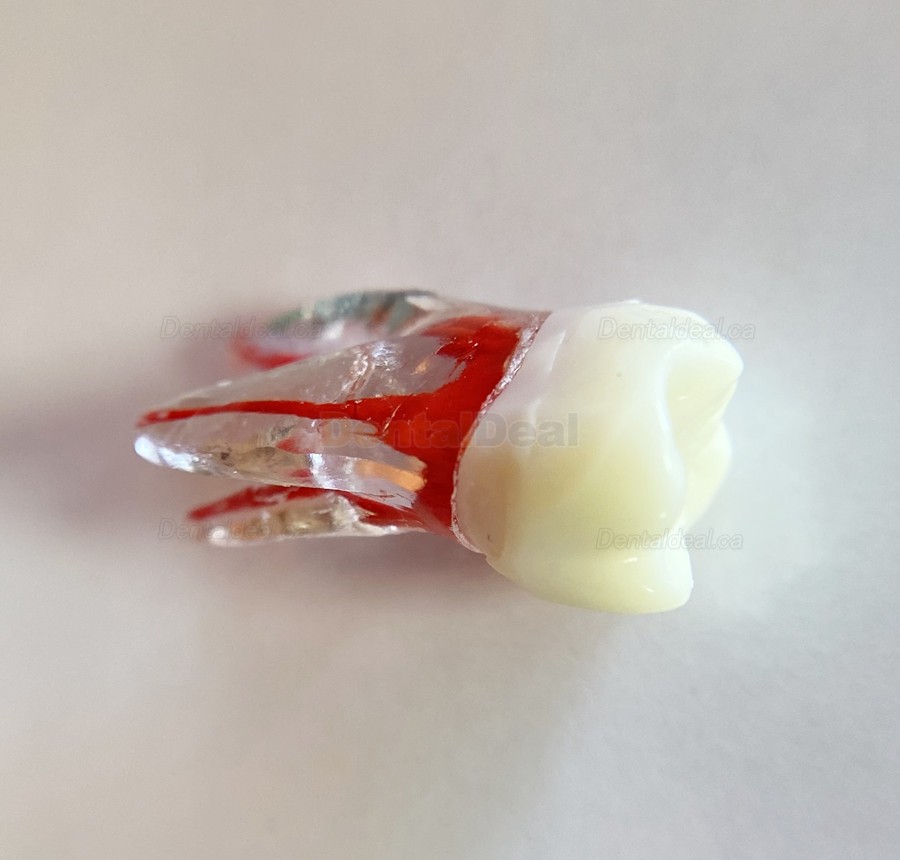 Dental Teeth Practice Model Endo File Molar Upper Lower Tooth Premolar Root 2/3-Rooted Canal